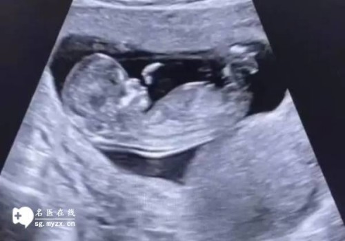 深圳助孕代怀生男孩：﻿不是每个人都能做无痛分娩，这几类不能做无痛分娩的人群有你一个吗？