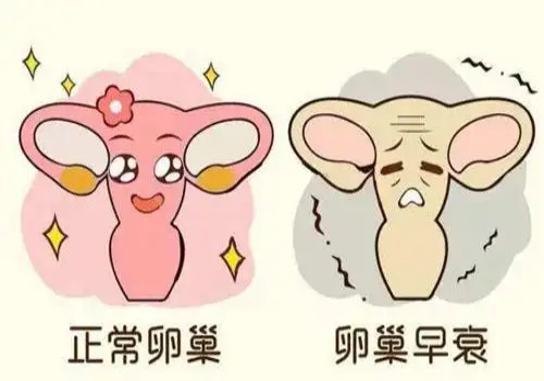 深圳试管助孕公司：胖多囊的高效减肥方法，让你远离多囊的困扰